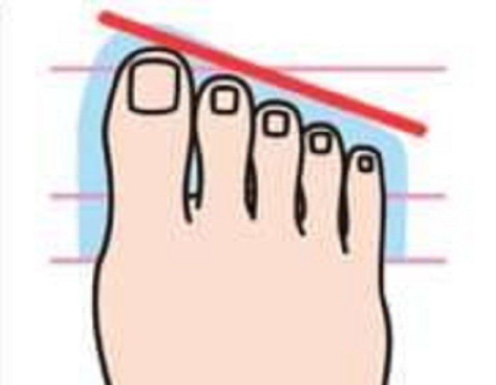 Какие бывают пальцы ног. Форма пальцев стопы. Средний палец на ноге длиннее большого. Форма пальцев на ногах.